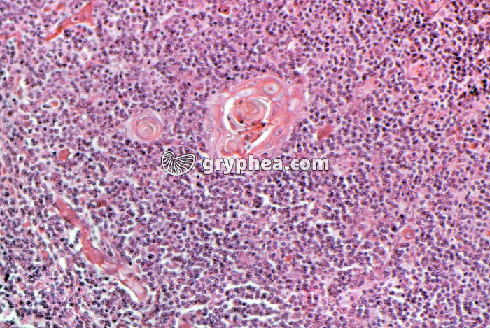 Thymus jeune x100 - gryphea.org